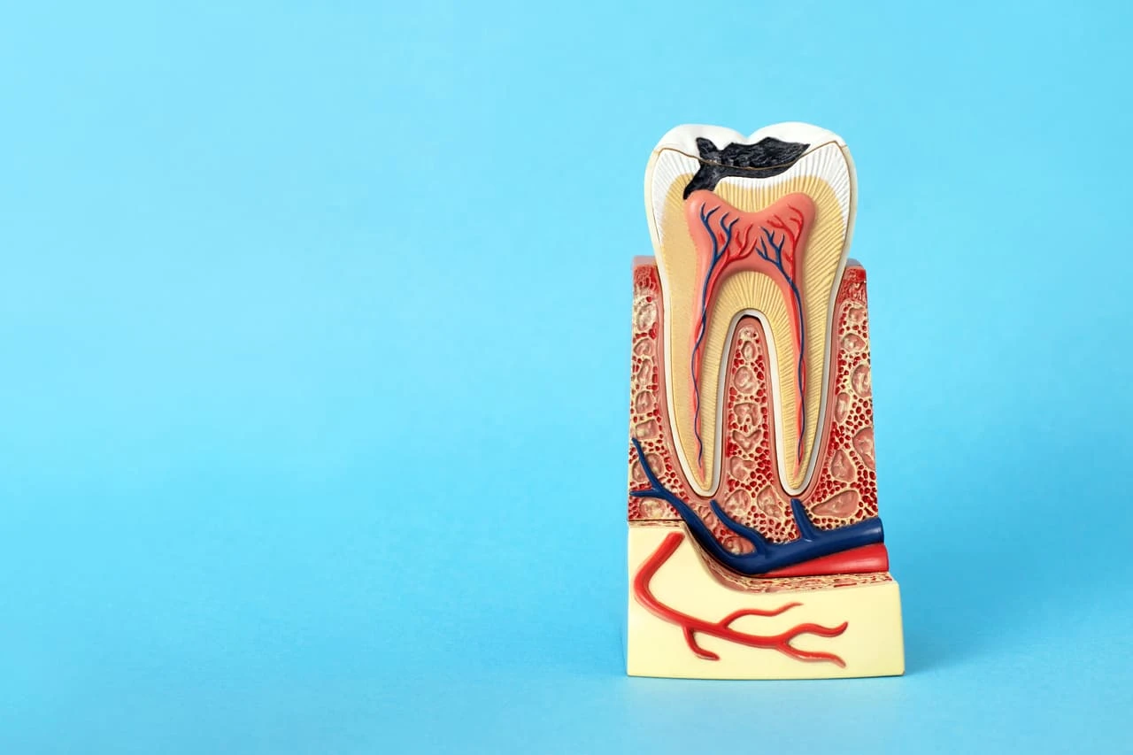 koreninsko zdravljenje -endodontija -implantoloski center