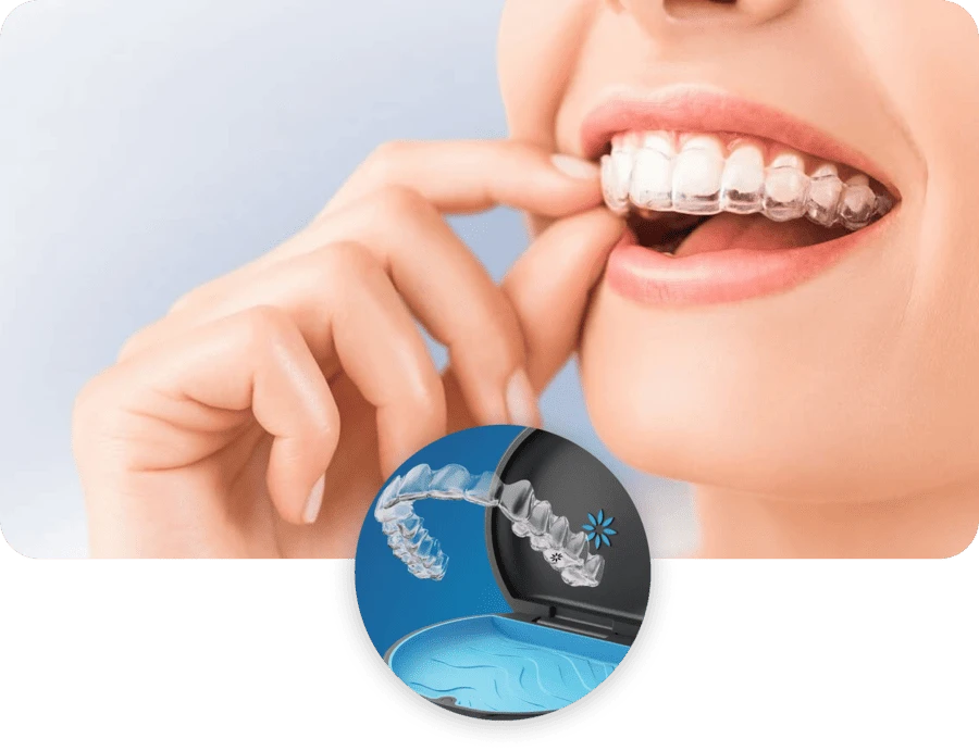 invisalign in ortodontija -implantoloski center